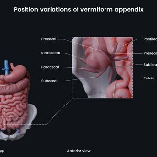 Position variations of vermiform appendix image