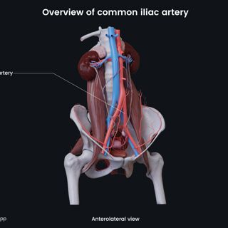 Overview of common iliac artery (female) image