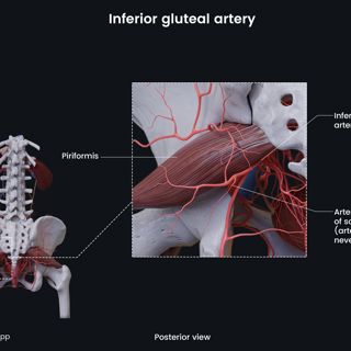 Inferior gluteal artery (female) image