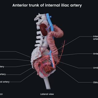 Anterior trunk of internal iliac artery (female) image