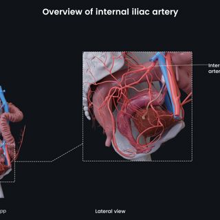 Overview of internal iliac artery (female) image