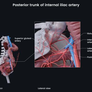 Posterior trunk of internal iliac artery (female) image