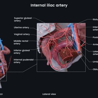 Internal iliac artery (female) image