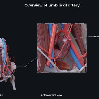 Overview of umbilical artery (female) image