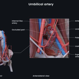 Umbilical artery (female) image