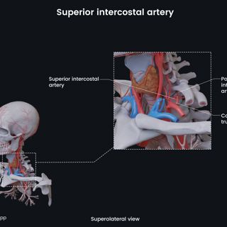 Superior intercostal artery image