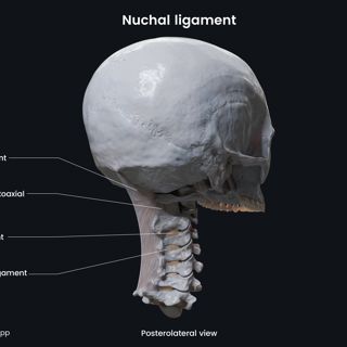 Nuchal ligament (posterolateral view) image