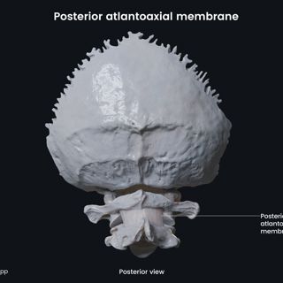 Posterior atlantoaxial membrane image
