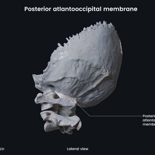 Posterior atlantooccipital membrane (lateral view) image