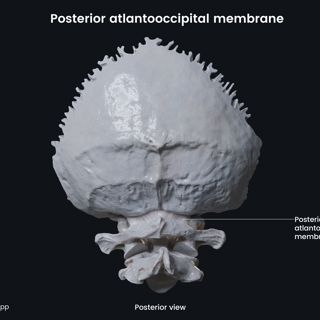 Posterior atlantooccipital membrane image