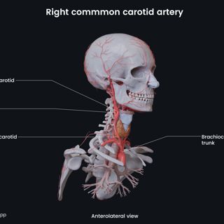 Right common carotid artery image