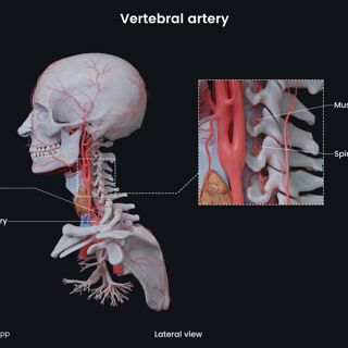 Vertebral artery image