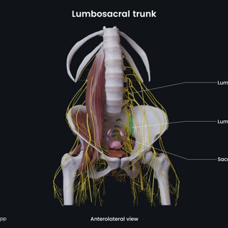 Lumbosacral trunk (female pelvis) image