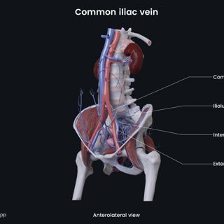Common iliac vein (female) image