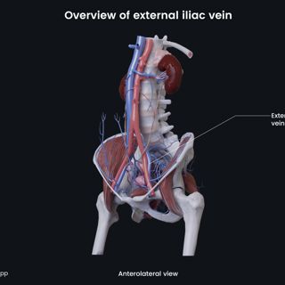 Overview of external iliac vein (female) image