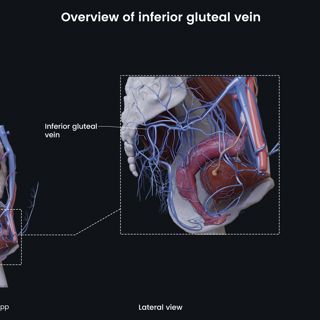 Overview of inferior gluteal vein (female) image