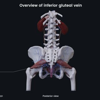 Overview of inferior gluteal vein (female) image
