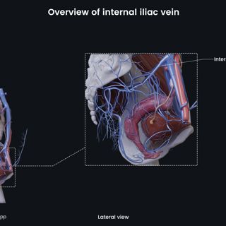 Overview of internal iliac vein (female) image