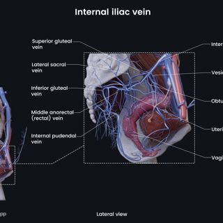 Internal iliac vein (female) image