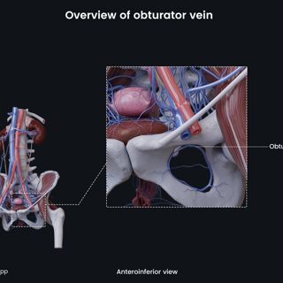 Overview of obturator vein (female) image