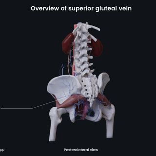 Overview of superior gluteal vein (female) image