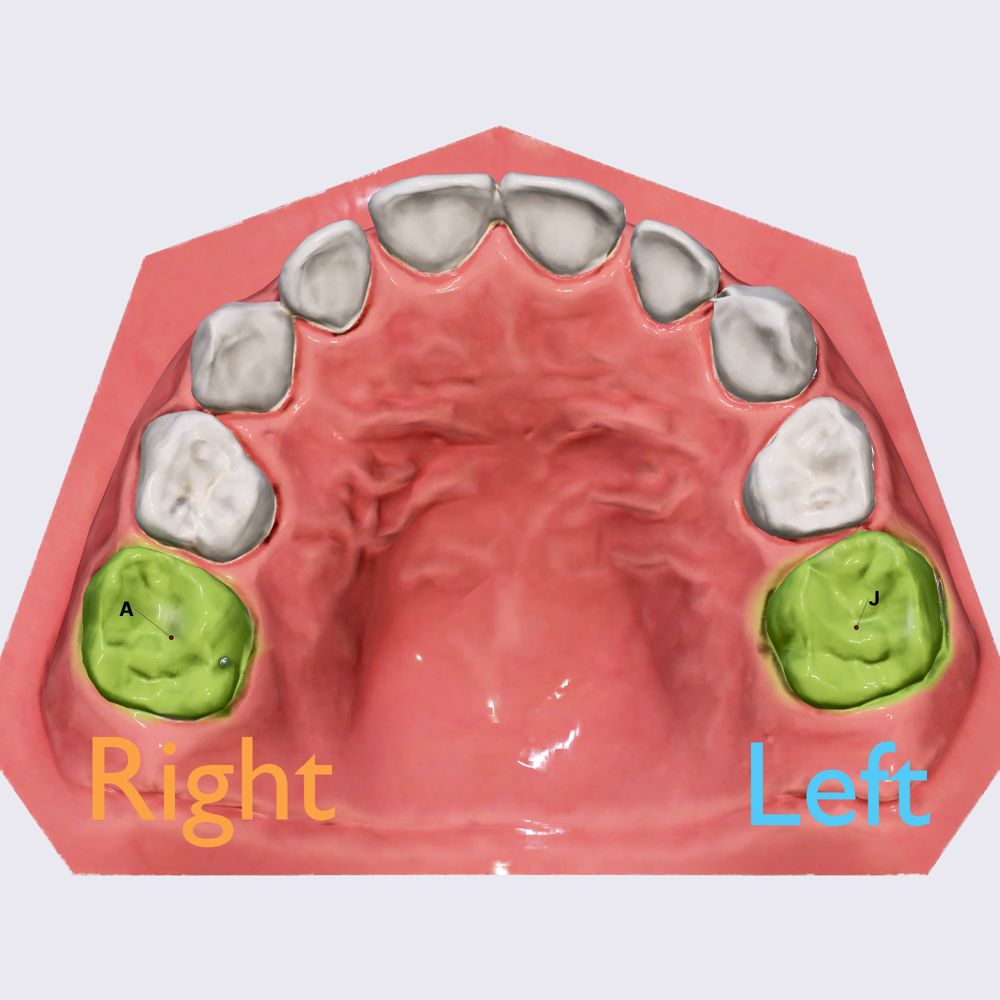 Second maxillary molar tooth