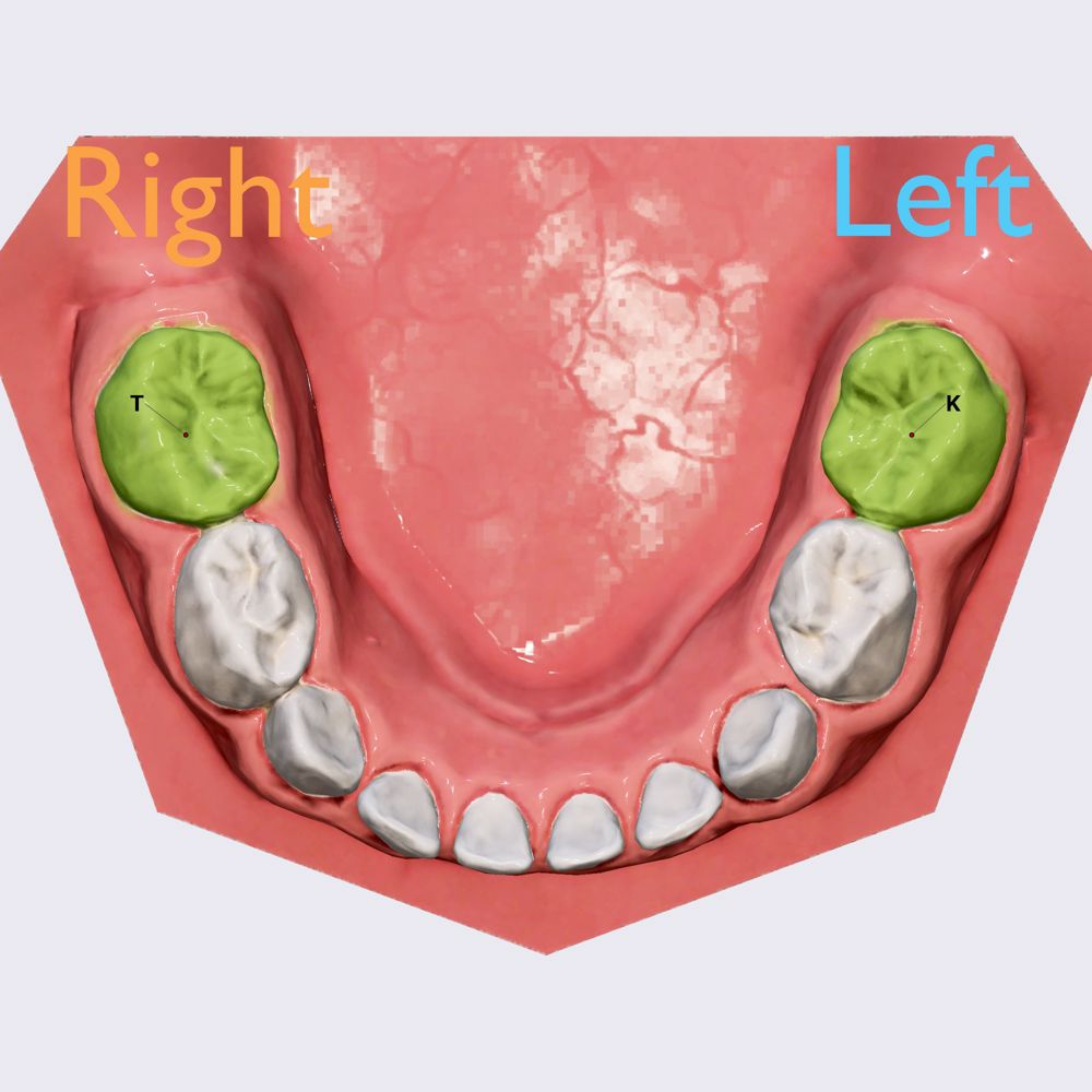 Second mandibular molar tooth