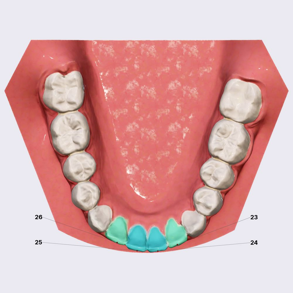 Mandibular incisors