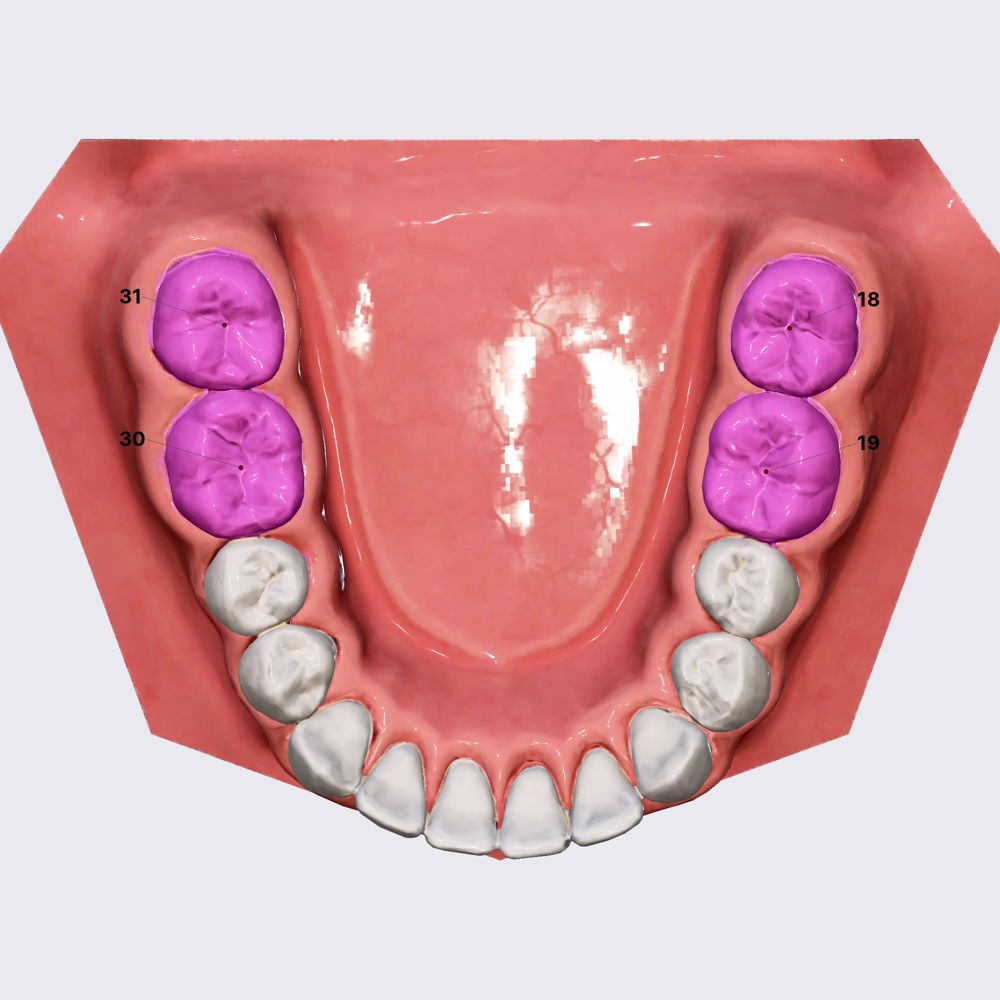 Mandibular molars