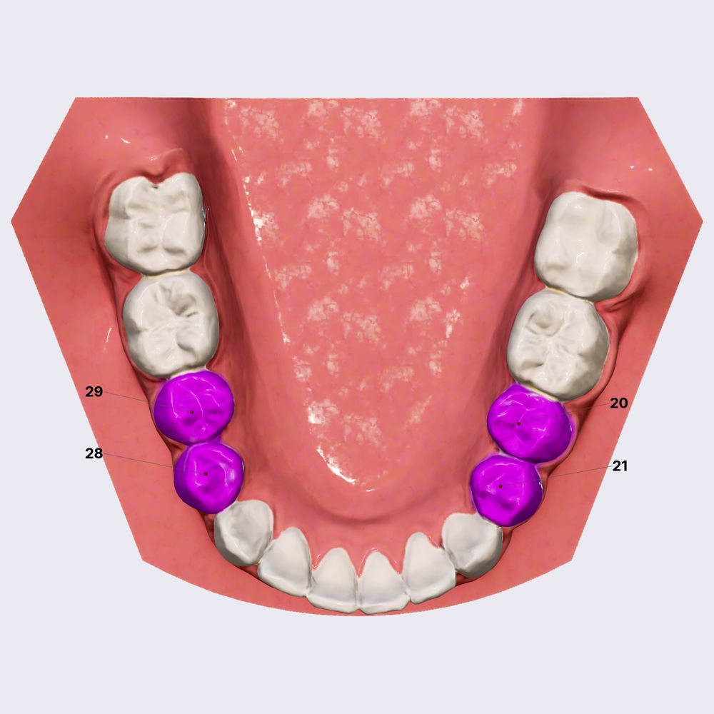 Mandibular premolars