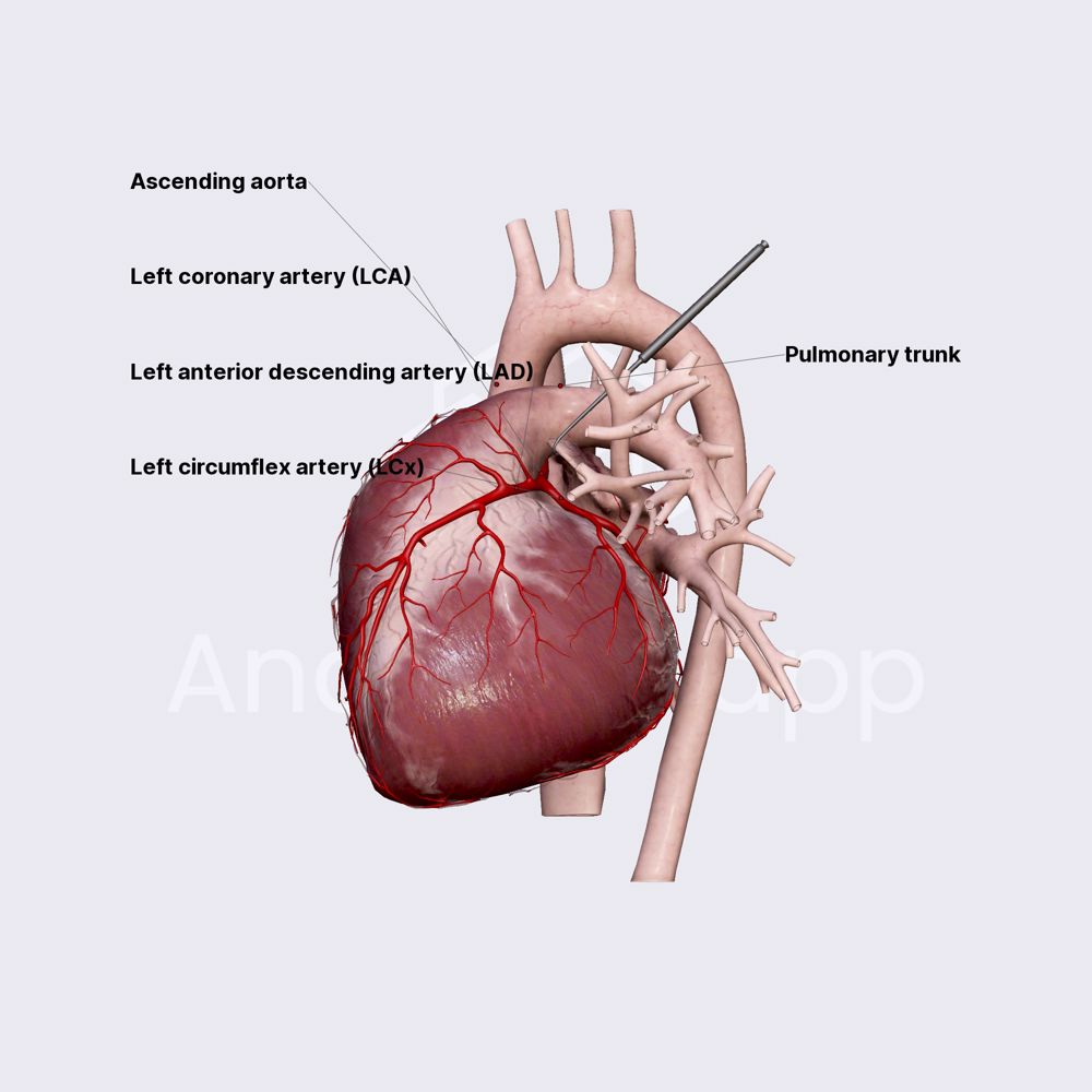 Left coronary artery (LCA)