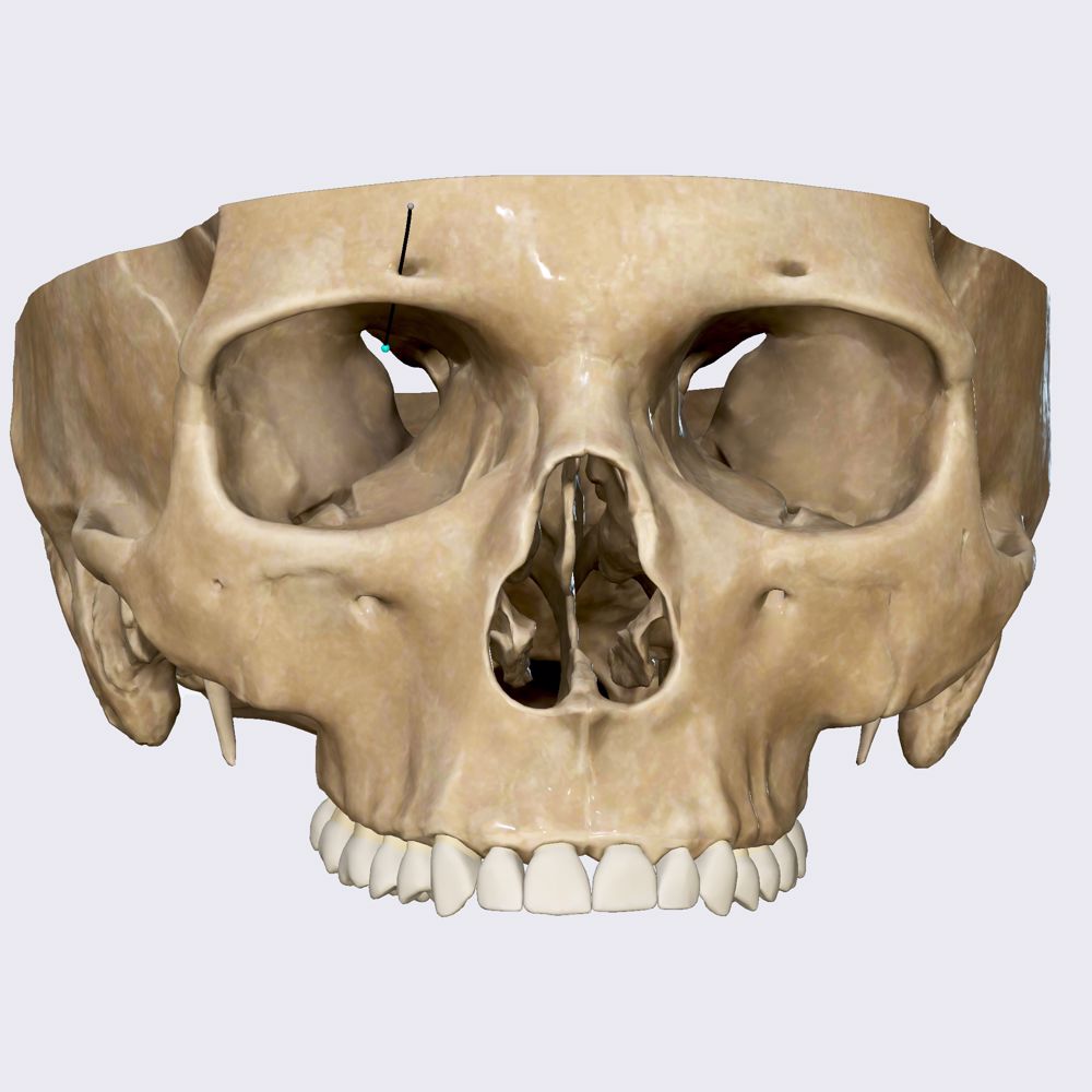 Supraorbital foramen