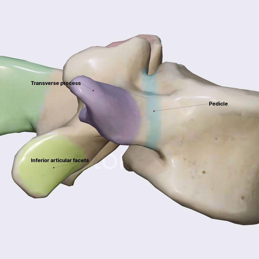 Atypical lumbar vertebra (L5)