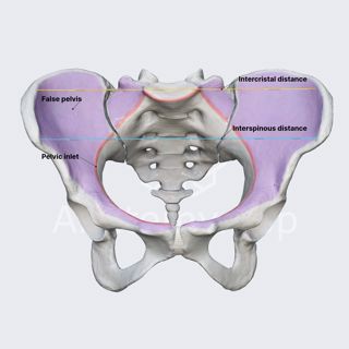 False pelvis image