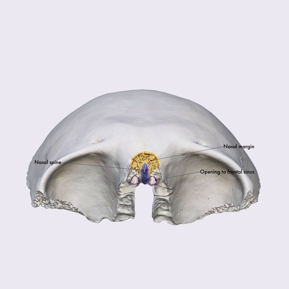 Frontal bone (nasal part)