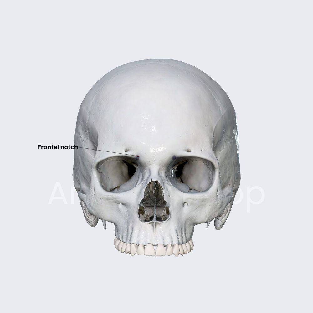 Frontal (supratrochlear) foramen (or notch)