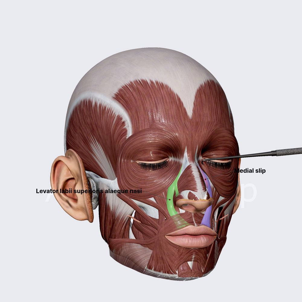 Levator labii superioris alaeque nasi