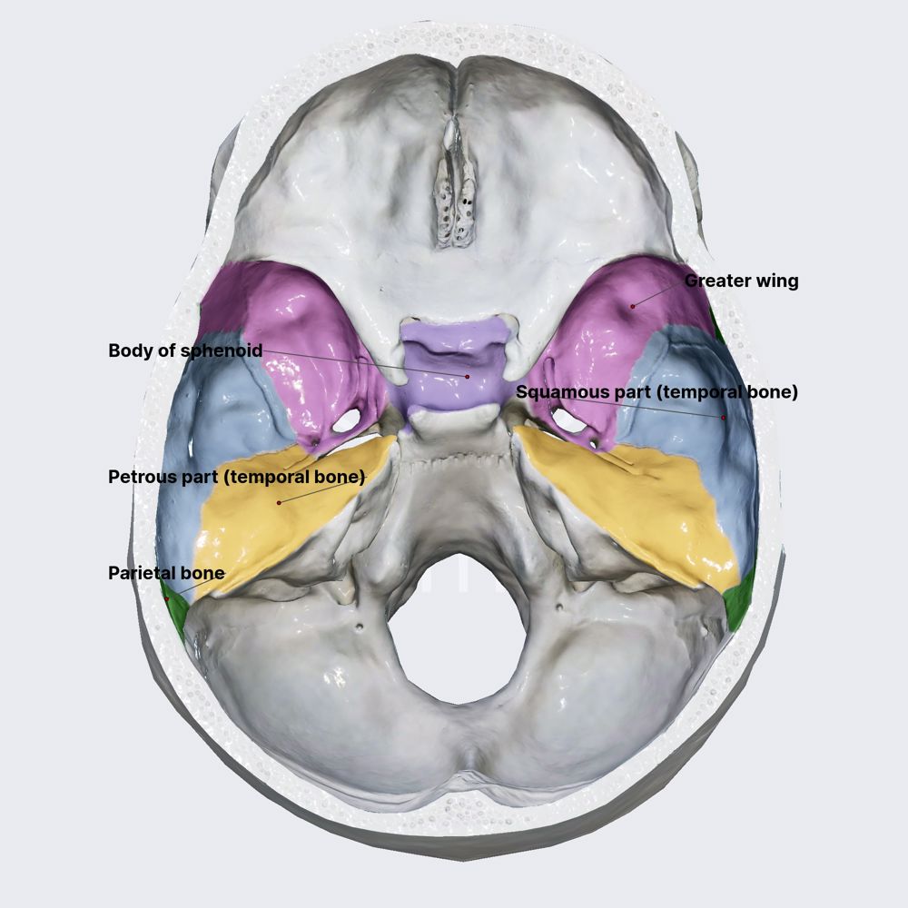 Middle cranial fossa (walls)