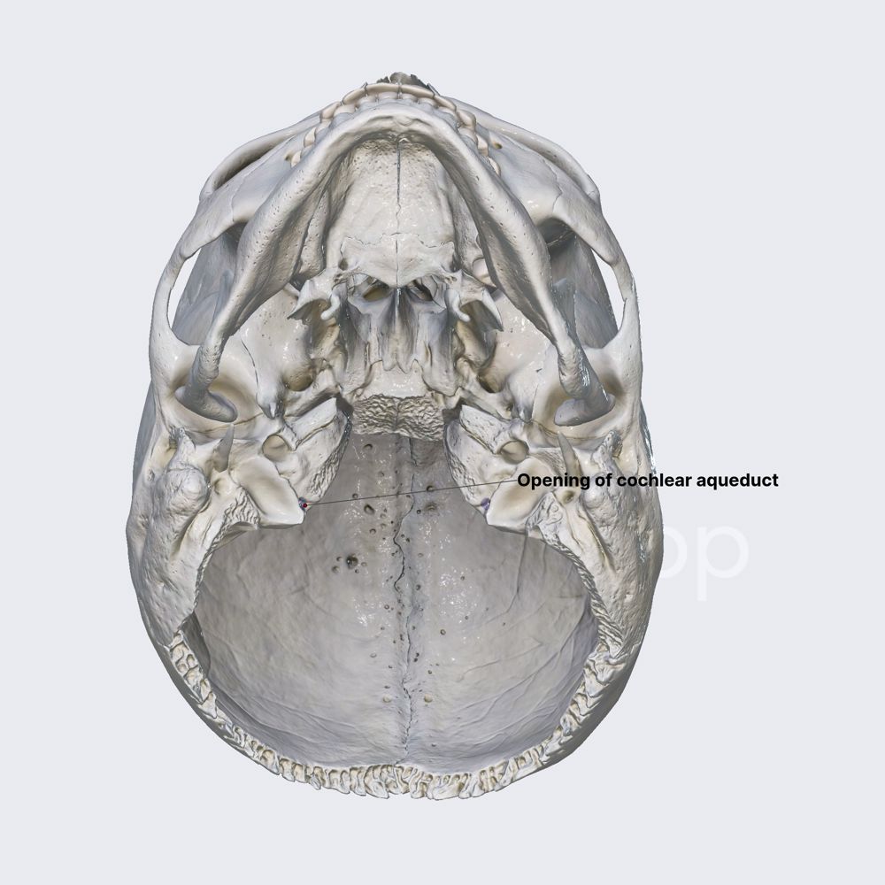 Opening of cochlear aqueduct