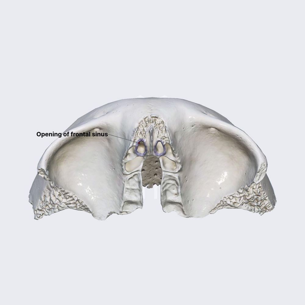 Opening of frontal sinus