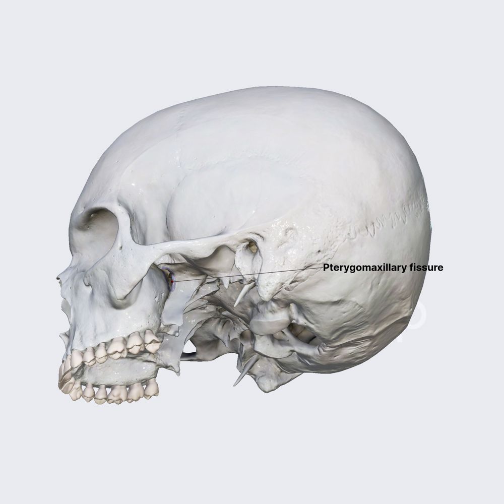 Pterygomaxillary fissure