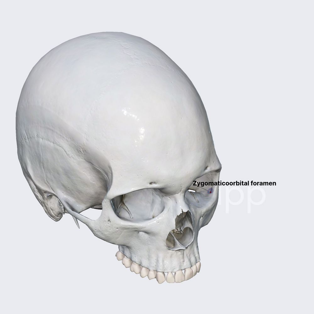 Zygomaticoorbital foramen