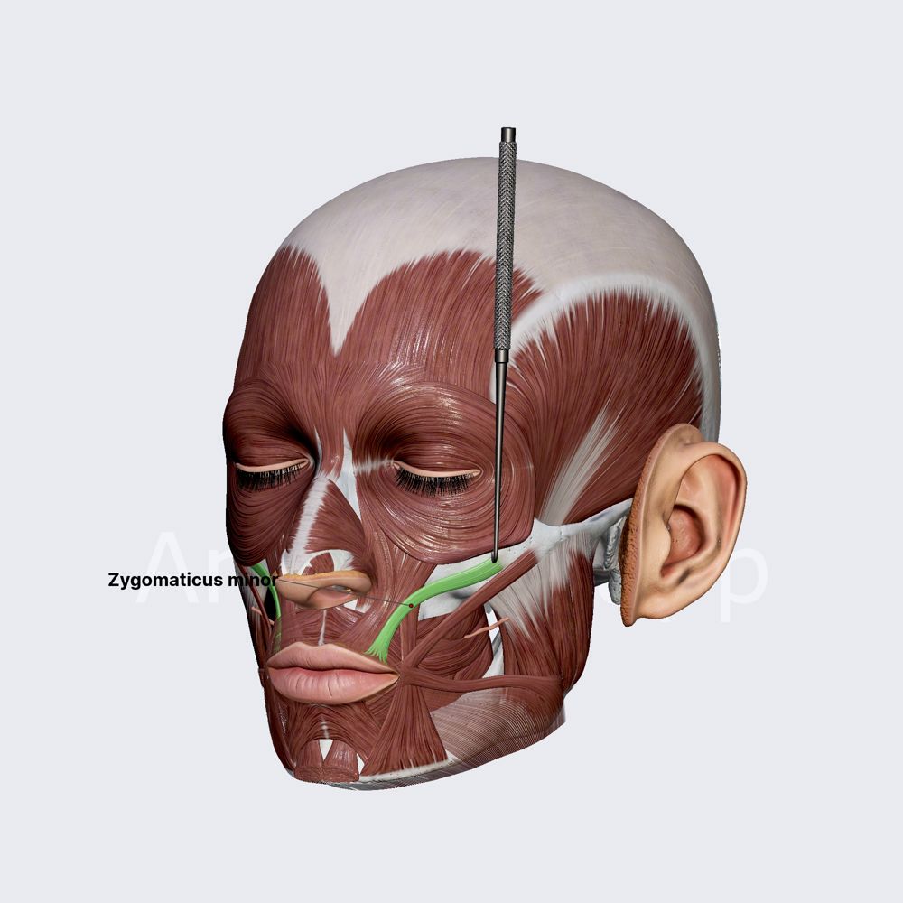 Zygomaticus minor