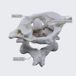 Axial rotation image