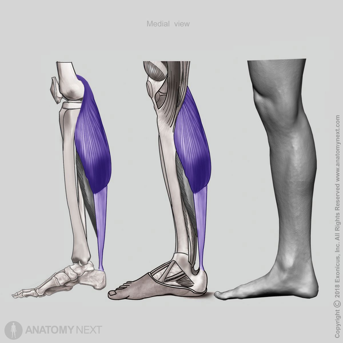 Gastrocnemius, Origin of gastrocnemius, Insertion of gastrocnemius, Superficial layer of posterior leg muscles, Superficial posterior leg muscles, Posterior compartment muscles, Posterior compartment of leg, Leg muscles, Human leg, Medial view of gastrocnemius