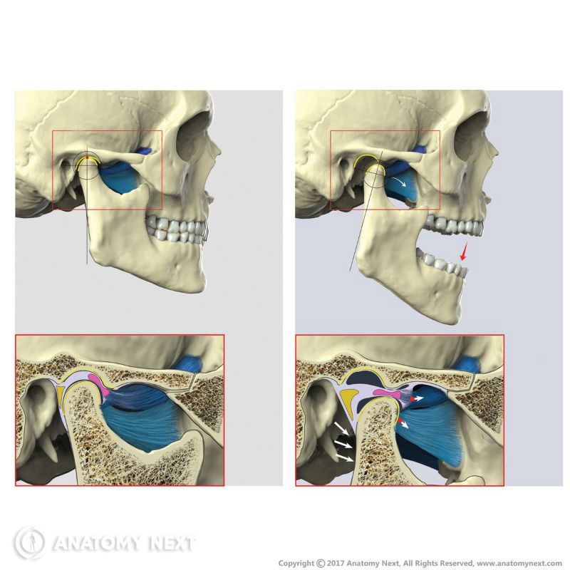 Action of lateral pterygoid, Function of lateral pterygoid, Lateral pterygoid