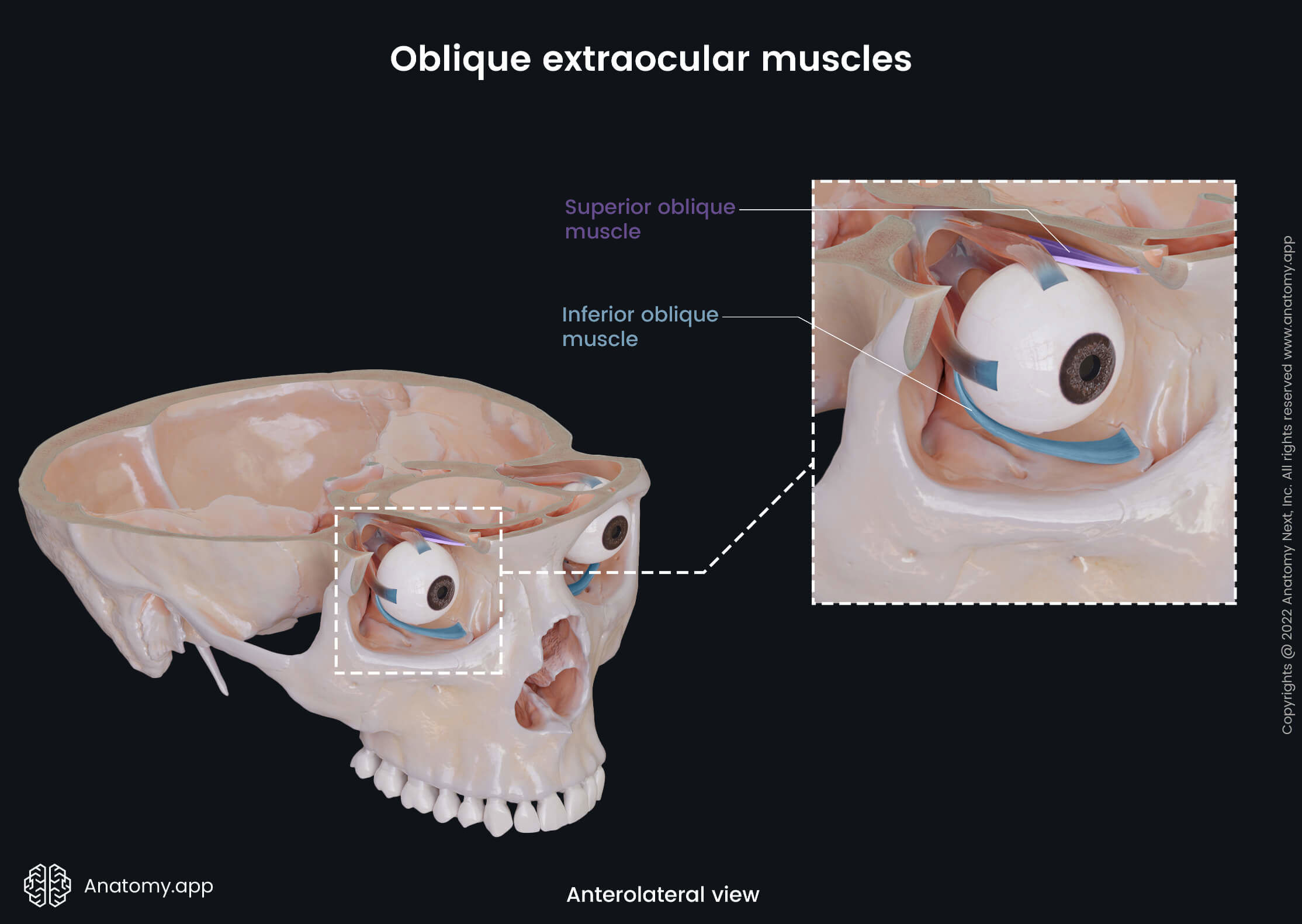 Extraocular muscles, Oblique muscles, Superior oblique, Inferior oblique, Bony orbit, Skull, Anterolateral view