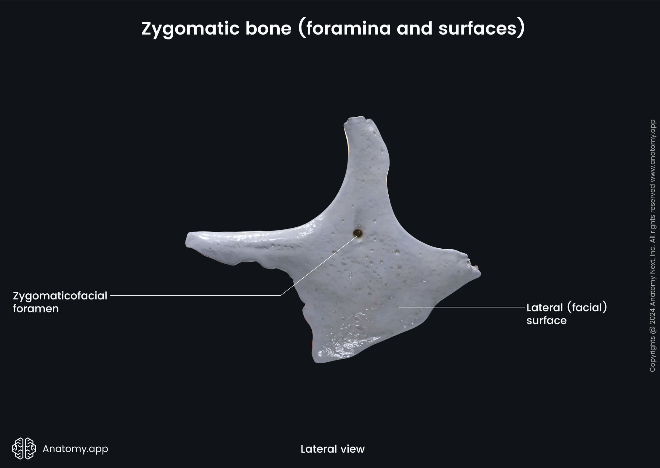 Head and neck, Skull, Viscerocranium, Facial skeleton, Zygomatic bone, Lateral surface, Landmarks of zygomatic bone, Medial view