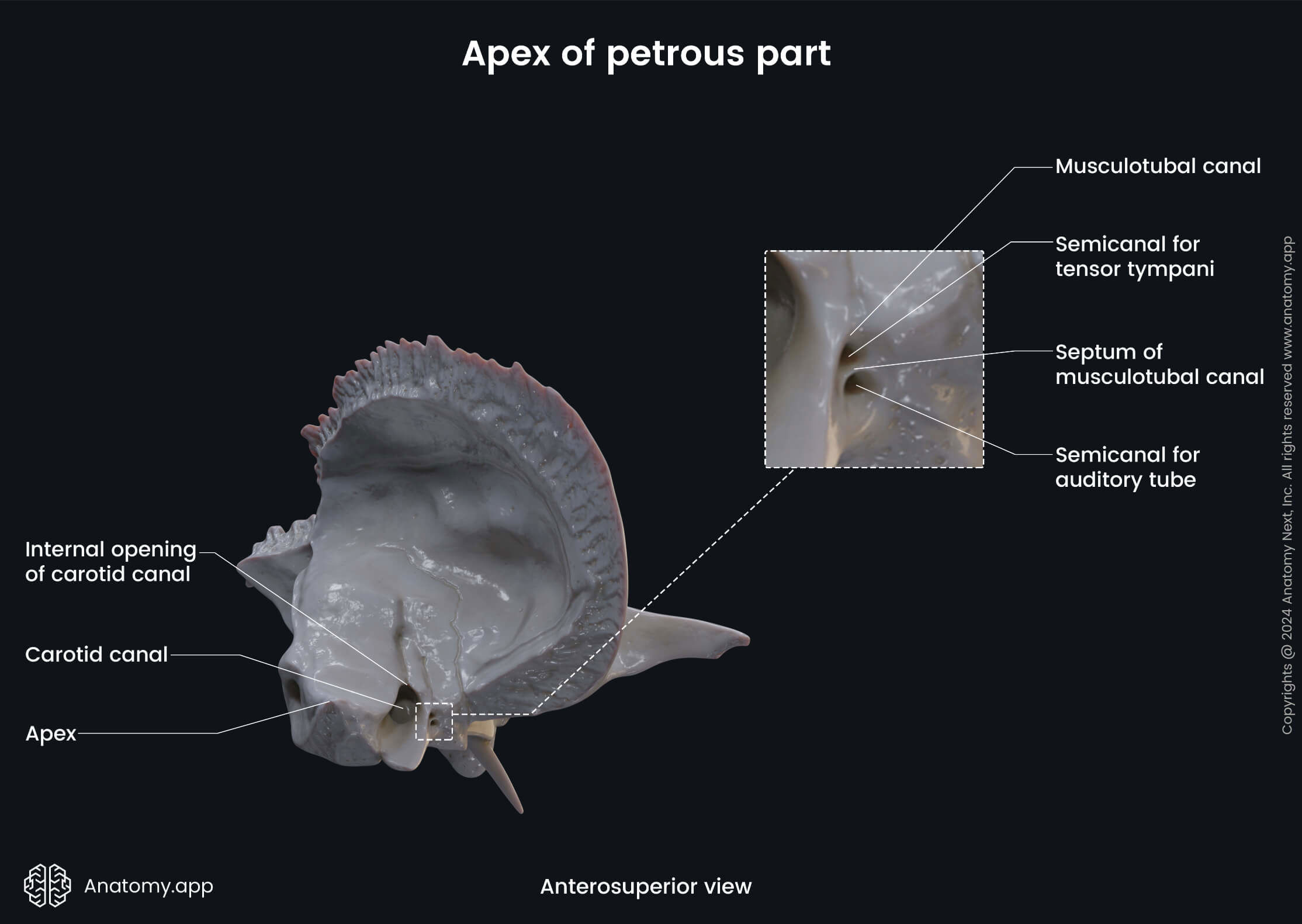 Head and neck, Skull, Cranium, Skeletal system, Neurocranium, Temporal bone, Petrous part, Landmarks, Apex, Anterosuperior view