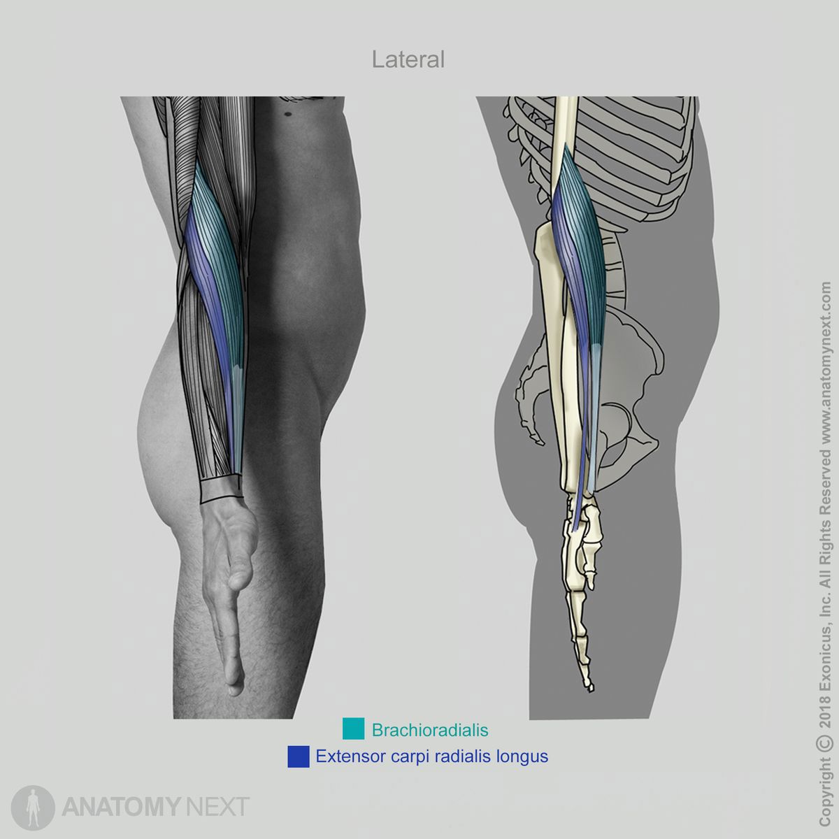 Brachioradialis, Extensor carpi radialis longus, Insertion of brachioradialis, Insertion of extensor carpi radialis longus, Lateral view of brachioradialis and extensor carpi radialis longus, Forearm muscles, Muscles of the forearm, Lateral compartment of forearm muscles, Lateral compartment muscles, Muscles of the upper limb, Arm muscles, Human muscles